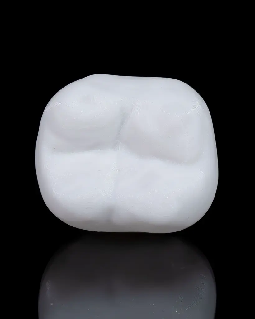 Dental_Implant_11_ee4f95850f.webp
