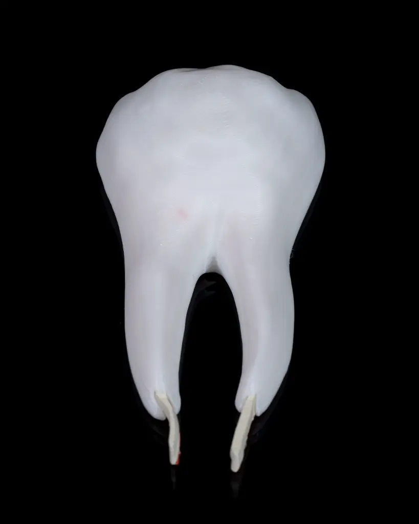 Healthy_Premolar_Tooth_6_ec366de120.webp