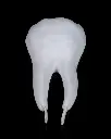 Healthy_Premolar_Tooth_6_ec366de120.webp