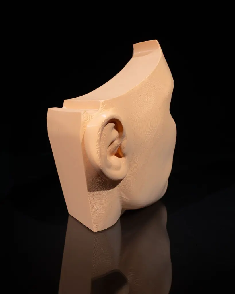 Nose_and_Sinus_3_60053b9fee.webp
