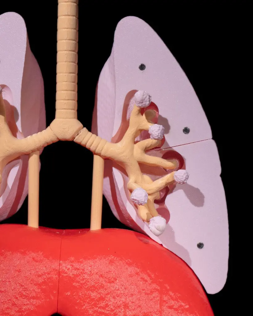 Lung_Anatomical_Model_4_e6c2b5ea37.webp