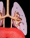 Lung_Anatomical_Model_4_e6c2b5ea37.webp