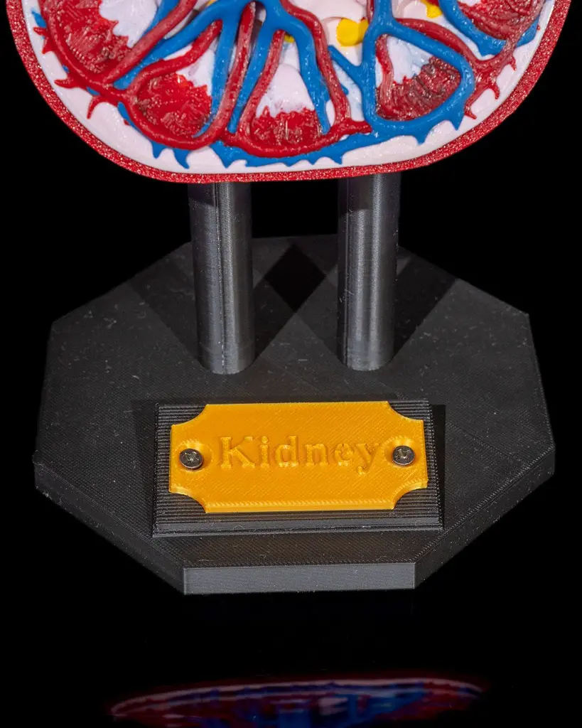 Kidney_Anatomical_Model_6_6ca68e0ba8.webp