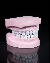 Upper_and_Lower_Dental_Arch_9_7f68fcebd6.webp