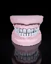 Upper_and_Lower_Dental_Arch_8_efedd60431.webp