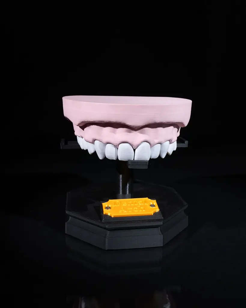 Upper_and_Lower_Dental_Arch_7_dd2593e3ae.webp