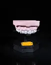 Upper_and_Lower_Dental_Arch_7_dd2593e3ae.webp