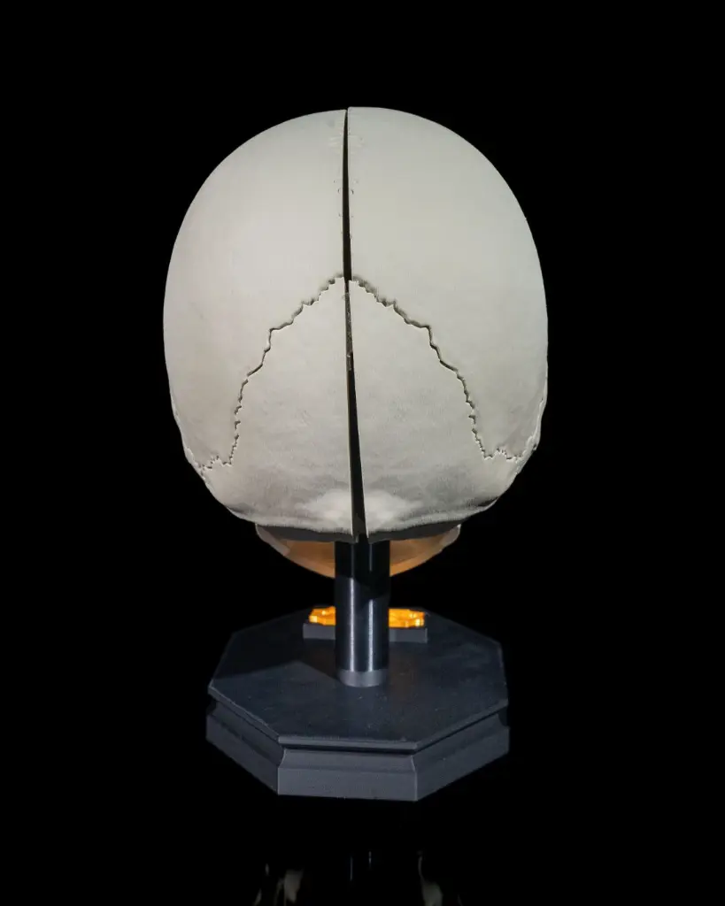 Human_Adult_Skull_4_f626573bb3.webp